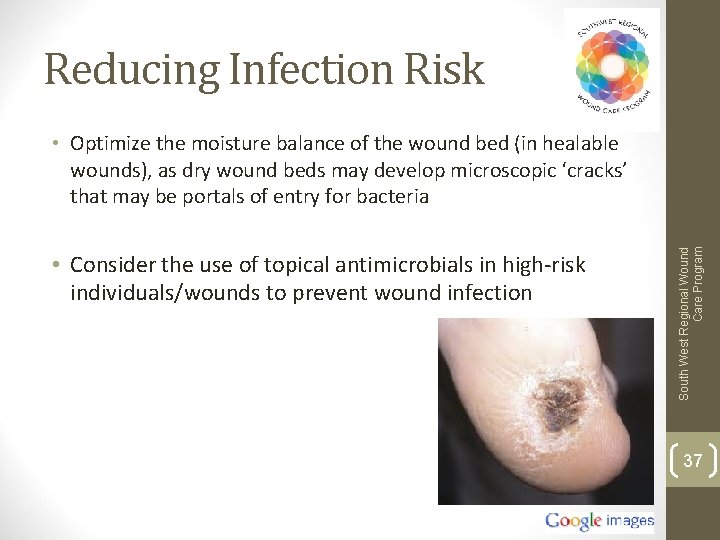 Reducing Infection Risk • Consider the use of topical antimicrobials in high-risk individuals/wounds to