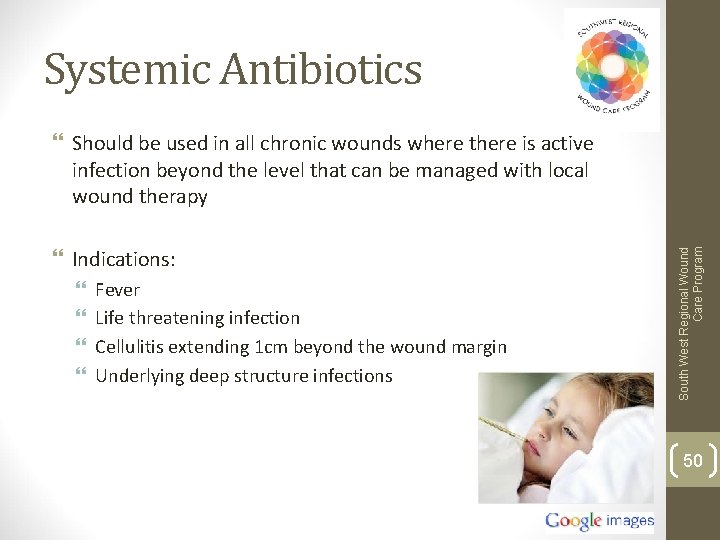 Systemic Antibiotics Indications: Fever Life threatening infection Cellulitis extending 1 cm beyond the wound