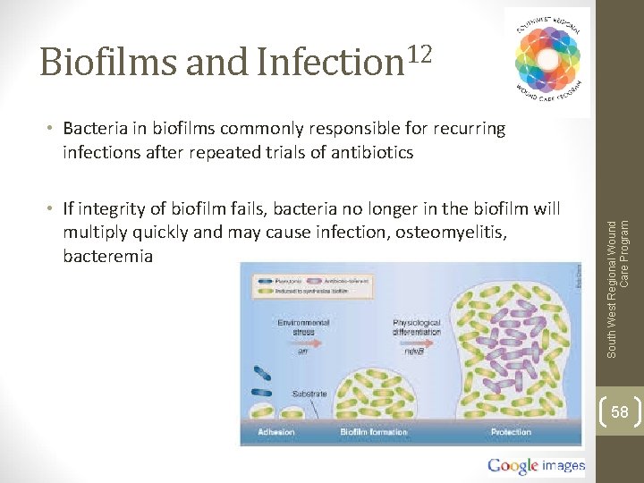 Biofilms and Infection 12 • If integrity of biofilm fails, bacteria no longer in