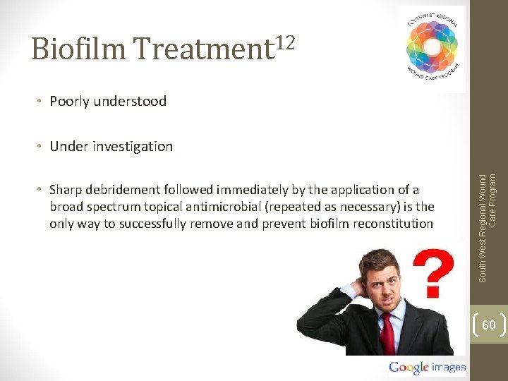 Biofilm Treatment 12 • Poorly understood • Sharp debridement followed immediately by the application