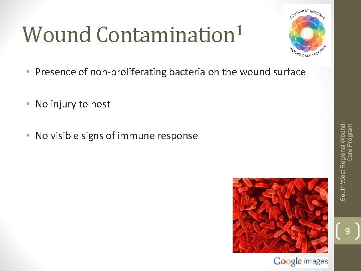 Wound Contamination 1 • Presence of non-proliferating bacteria on the wound surface • No