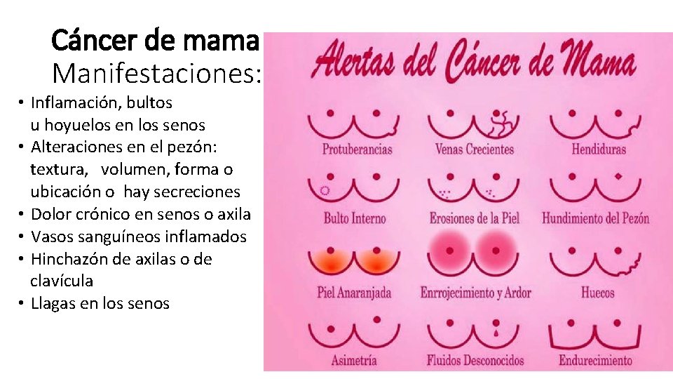 Cáncer de mama Manifestaciones: • Inflamación, bultos u hoyuelos en los senos • Alteraciones