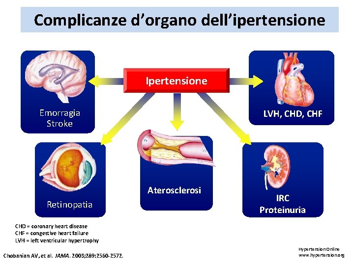 Complicanze d’organo dell’ipertensione Ipertensione Emorragia Stroke LVH, CHD, CHF Aterosclerosi Retinopatia IRC Proteinuria CHD