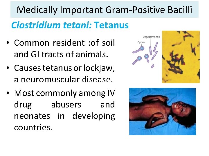 Medically Important Gram-Positive Bacilli Clostridium tetani: Tetanus • Common resident : of soil and