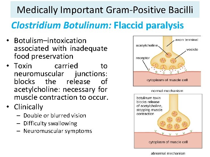Medically Important Gram-Positive Bacilli Clostridium Botulinum: Flaccid paralysis • Botulism–intoxication associated with inadequate food