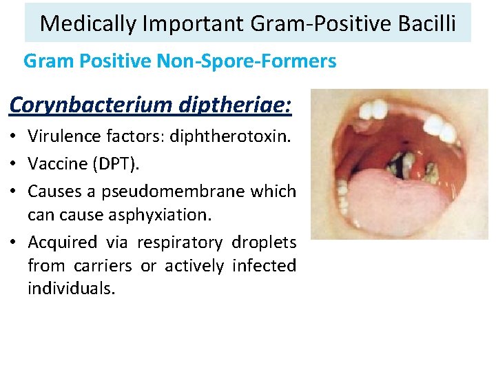 Medically Important Gram-Positive Bacilli Gram Positive Non-Spore-Formers Corynbacterium diptheriae: • Virulence factors: diphtherotoxin. •