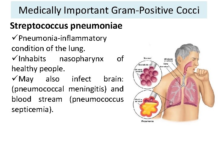 Medically Important Gram-Positive Cocci Streptococcus pneumoniae üPneumonia-inflammatory condition of the lung. üInhabits nasopharynx of