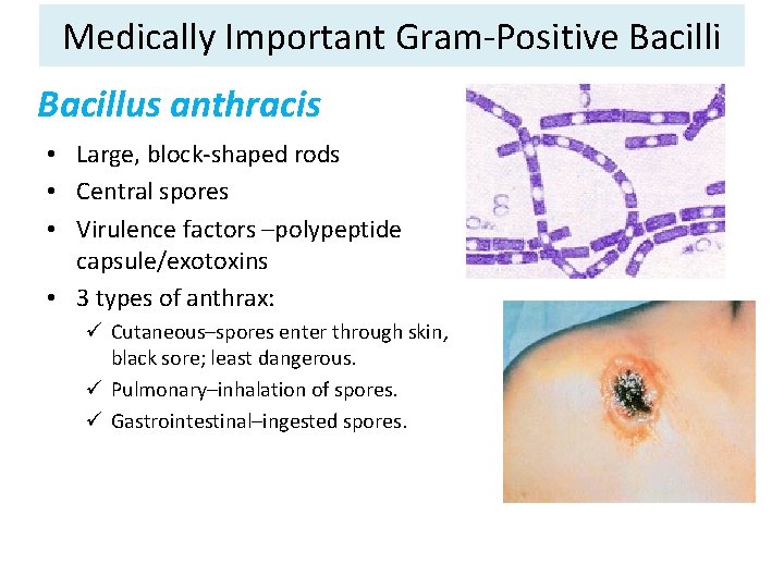 Medically Important Gram-Positive Bacilli Bacillus anthracis • Large, block-shaped rods • Central spores •