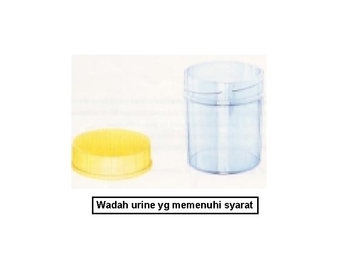 Wadah urine yg memenuhi syarat 