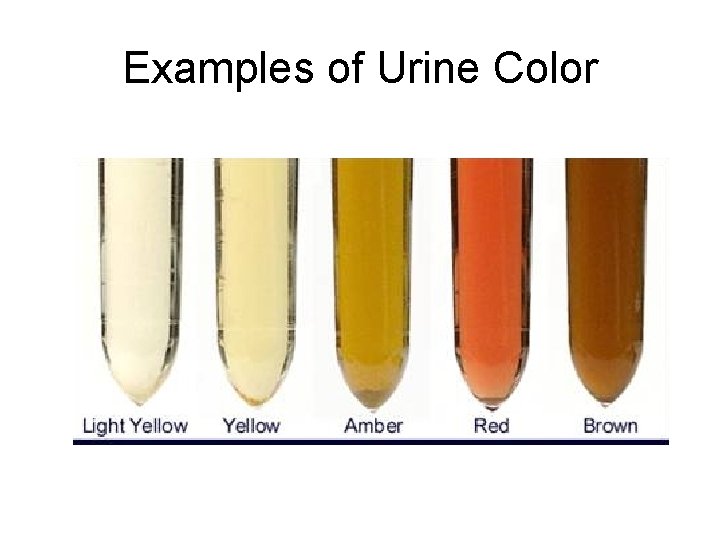 Examples of Urine Color 