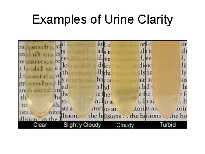 Examples of Urine Clarity 