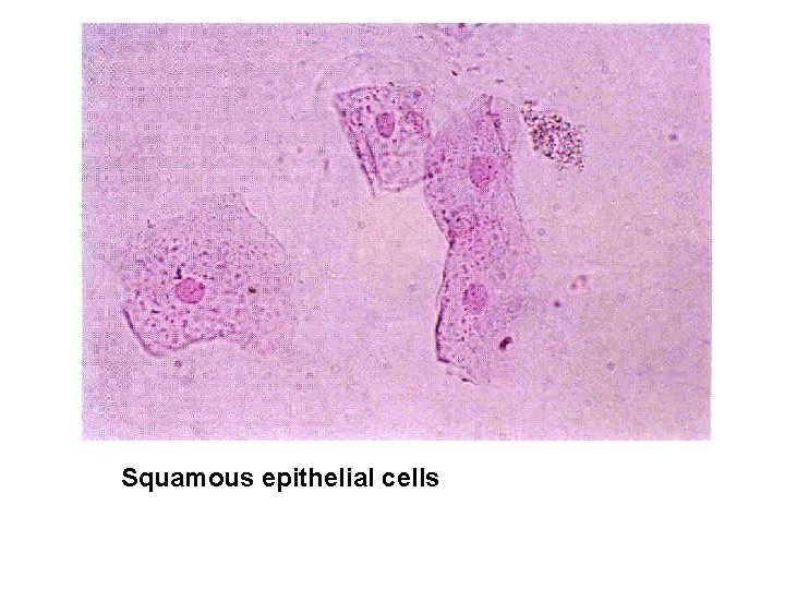 Squamous epithelial cells 