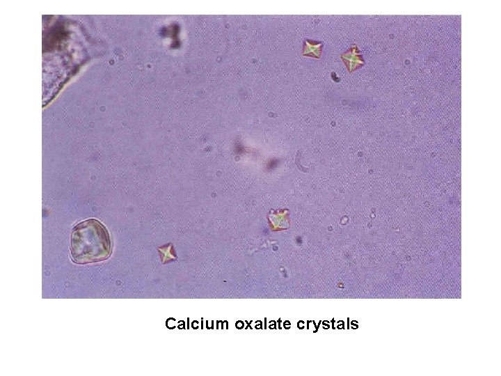 Calcium oxalate crystals 