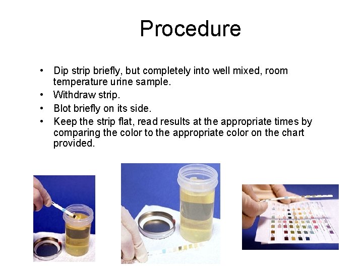 Procedure • Dip strip briefly, but completely into well mixed, room temperature urine sample.