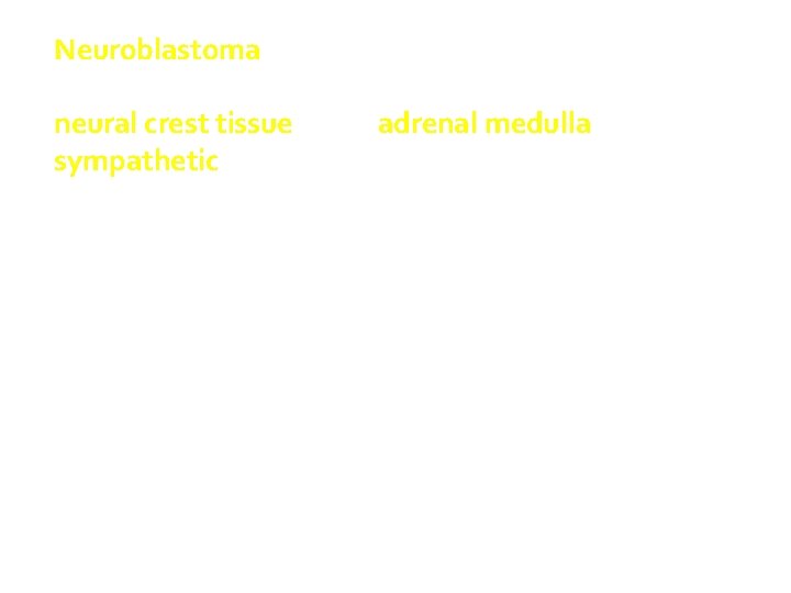 Neuroblastoma and related tumours arise from neural crest tissue in the adrenal medulla and