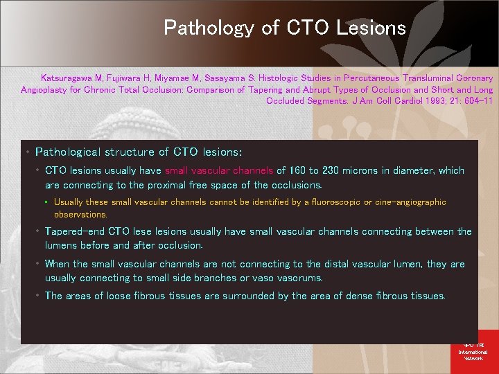 Pathology of CTO Lesions Katsuragawa M, Fujiwara H, Miyamae M, Sasayama S. Histologic Studies