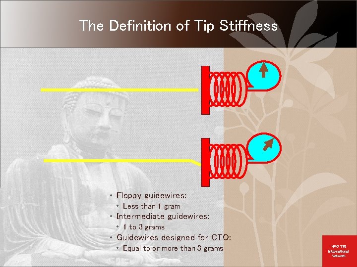 Antegrade Guidewire Basics Guidewire Tip Shaping Escalation Strategies