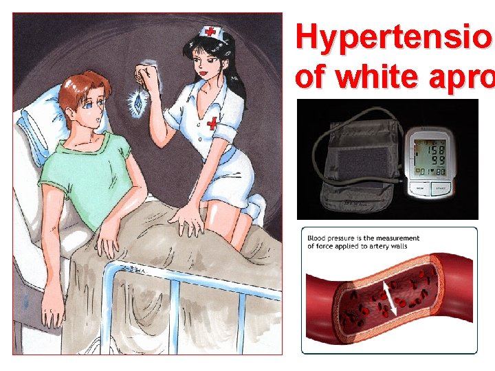 Hypertension of white apro 