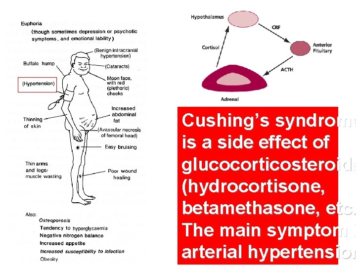 Cushing’s syndrome is a side effect of glucocorticosteroids (hydrocortisone, betamethasone, etc. The main symptom