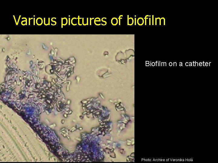 Various pictures of biofilm Biofilm on a catheter Photo: Archive of Veronika Holá 