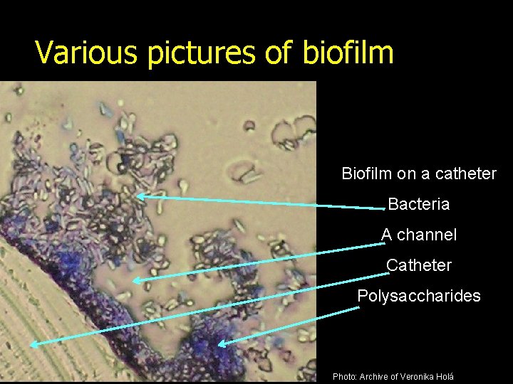 Various pictures of biofilm Biofilm on a catheter Bacteria A channel Catheter Polysaccharides Photo: