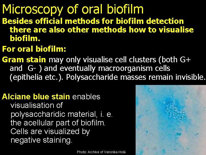 Microscopy of oral biofilm Besides official methods for biofilm detection there also other methods