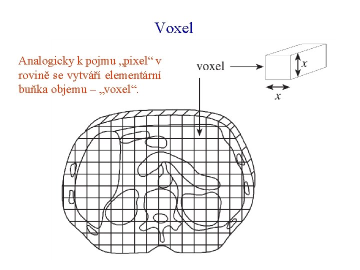 Voxel Analogicky k pojmu „pixel“ v rovině se vytváří elementární buňka objemu – „voxel“.