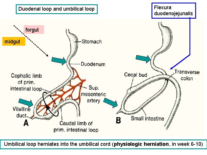 Duodenal loop and umbilical loop Flexura duodenojejunalis forgut midgut Umbilical loop herniates into the