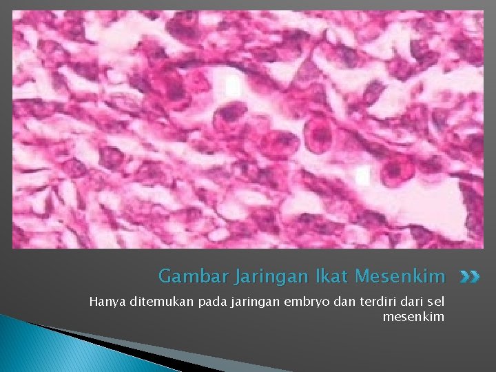 Gambar Jaringan Ikat Mesenkim Hanya ditemukan pada jaringan embryo dan terdiri dari sel mesenkim