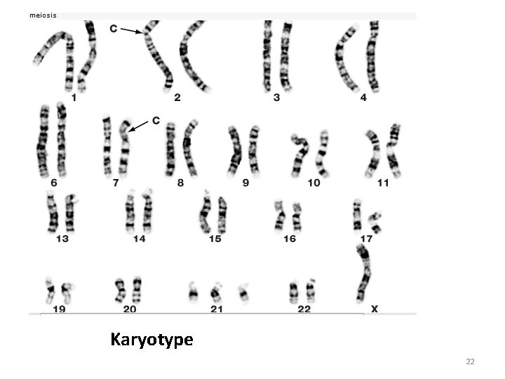 Karyotype 22 