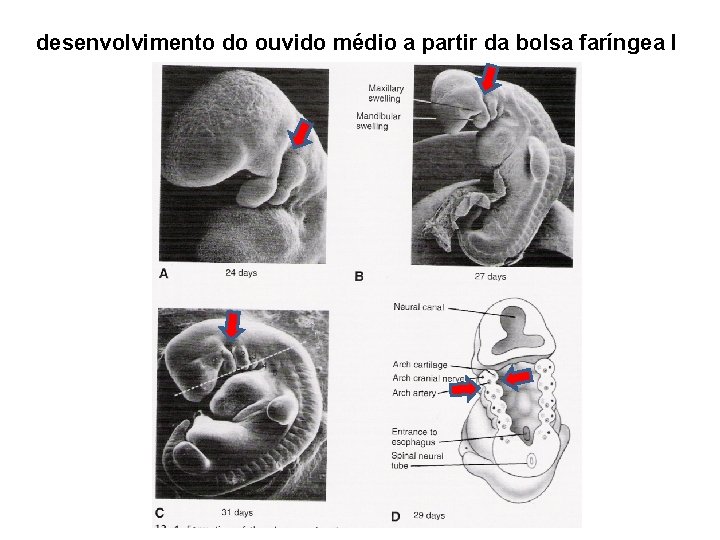 desenvolvimento do ouvido médio a partir da bolsa faríngea I 