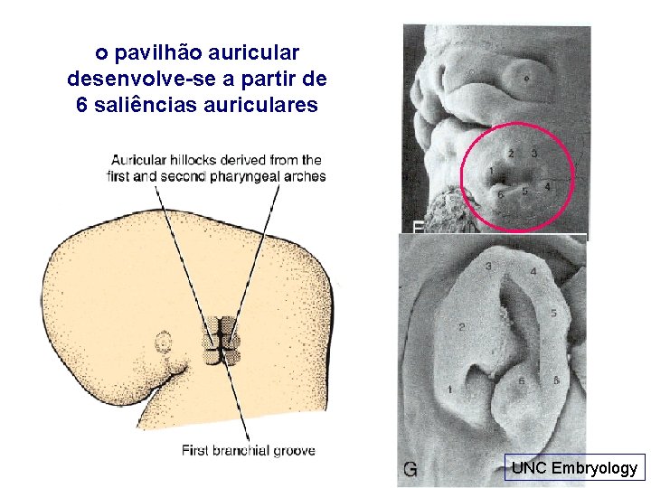 o pavilhão auricular desenvolve-se a partir de 6 saliências auriculares UNC Embryology 