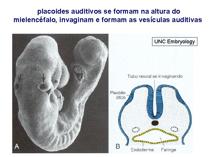 placoides auditivos se formam na altura do mielencéfalo, invaginam e formam as vesículas auditivas