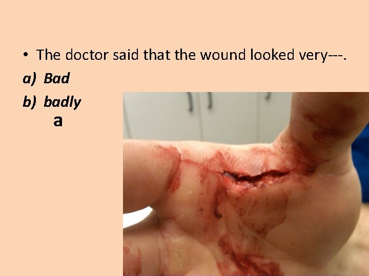  • The doctor said that the wound looked very---. a) Bad b) badly