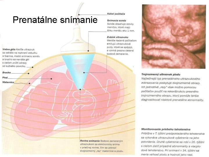 Prenatálne snímanie 