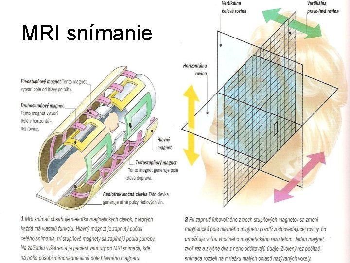 MRI snímanie 