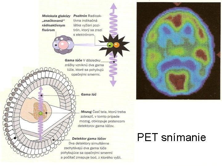  • PET snímanie 