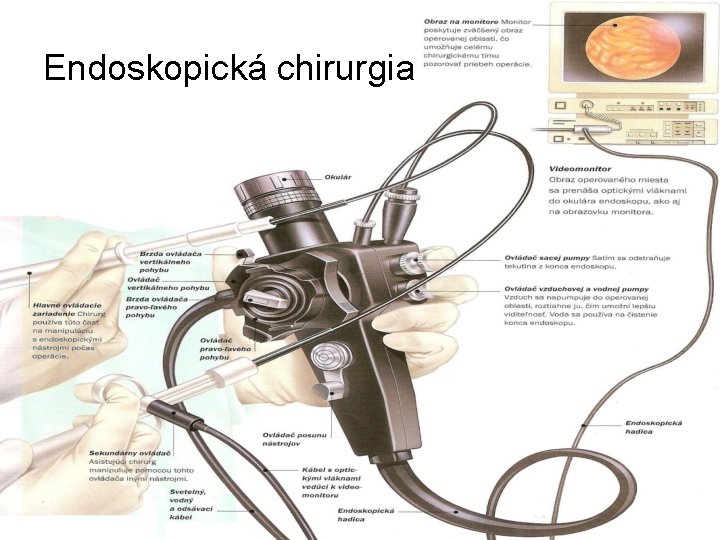 Endoskopická chirurgia 