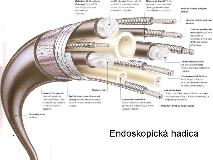  • Endoskopická hadica 