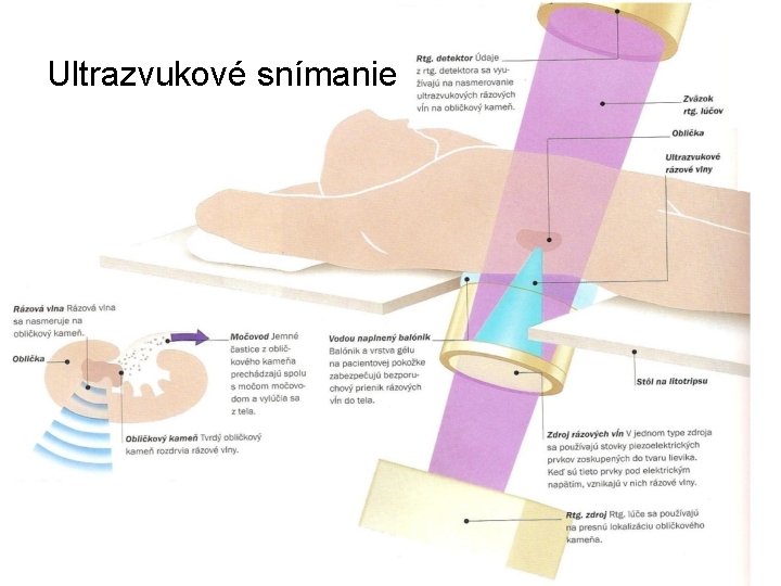 Ultrazvukové snímanie 