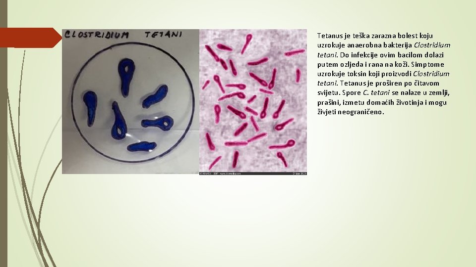 Tetanus je teška zarazna bolest koju uzrokuje anaerobna bakterija Clostridium tetani. Do infekcije ovim