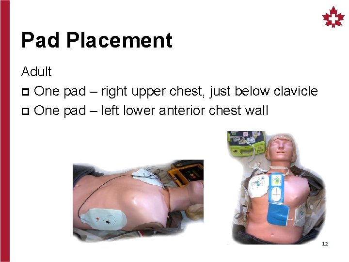 Pad Placement Adult p One pad – right upper chest, just below clavicle p