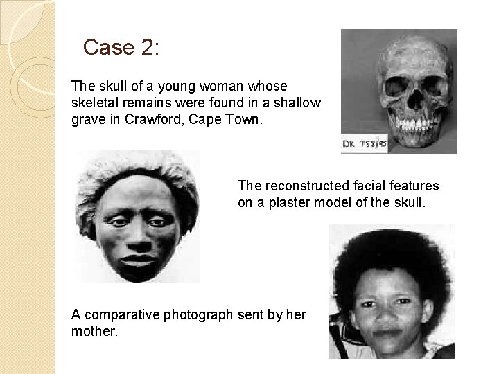 Case 2: The skull of a young woman whose skeletal remains were found in