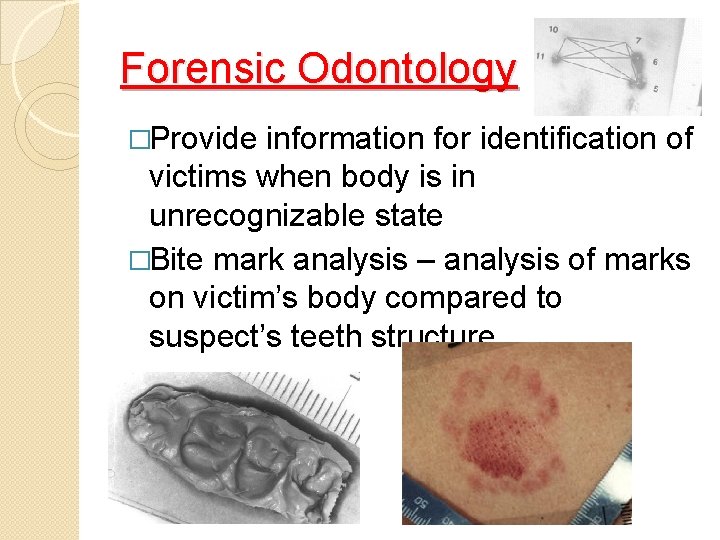Forensic Odontology �Provide information for identification of victims when body is in unrecognizable state