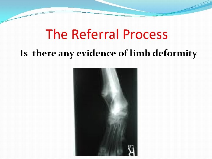 The Referral Process Is there any evidence of limb deformity 