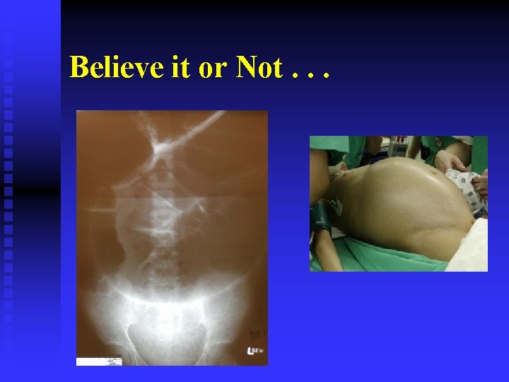 Believe it or Not. . . 