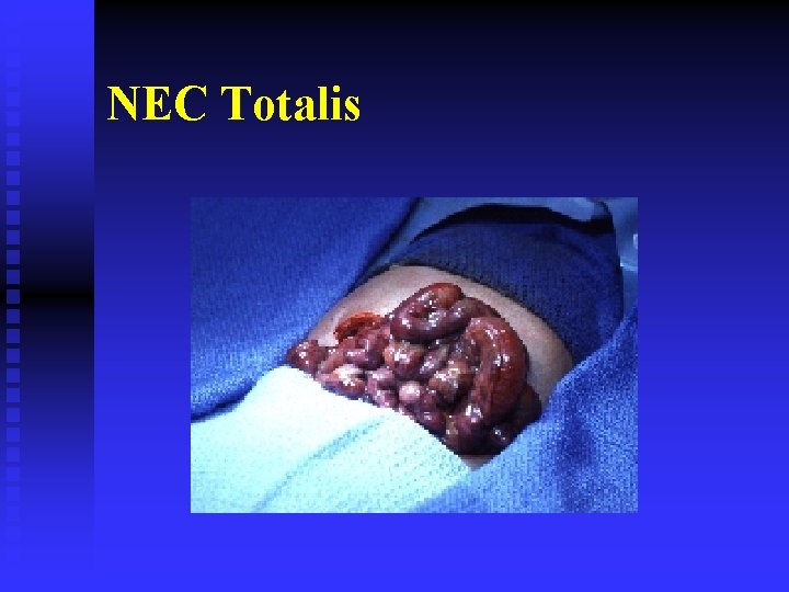 NEC Totalis 