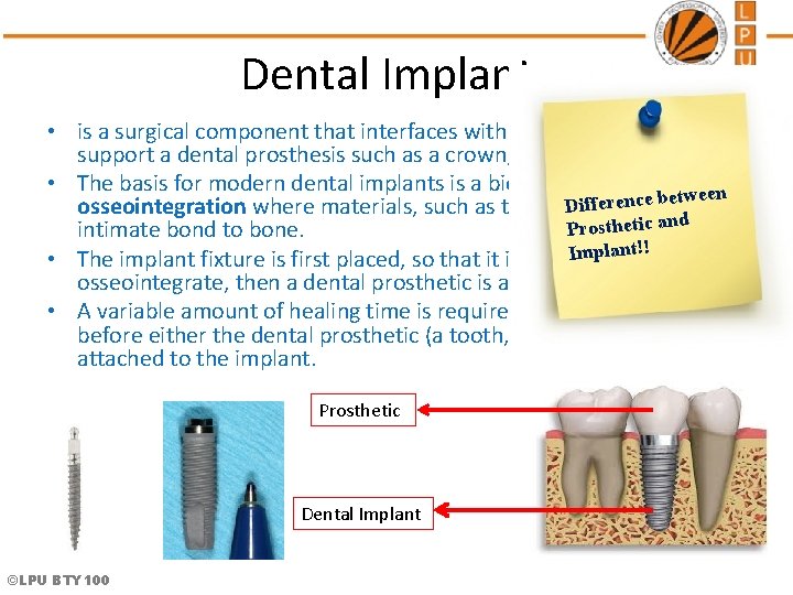 Dental Implants • is a surgical component that interfaces with the bone of the