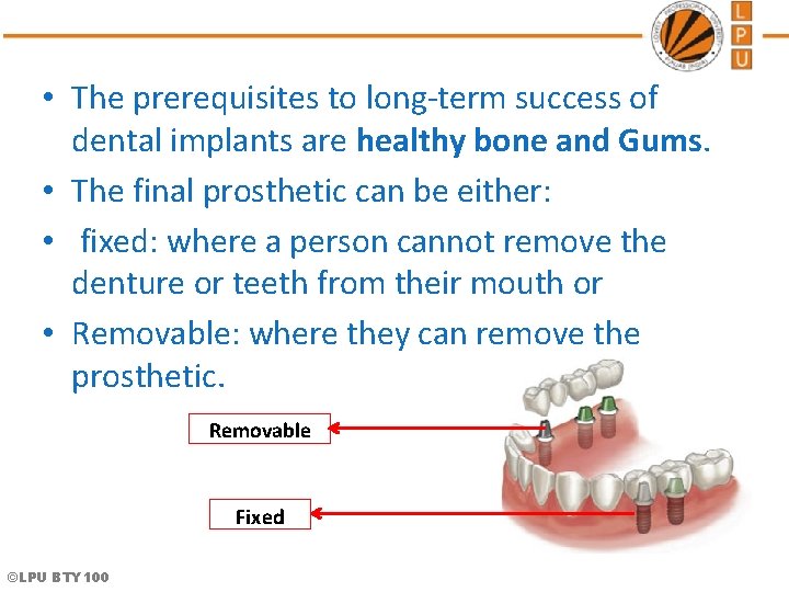  • The prerequisites to long-term success of dental implants are healthy bone and