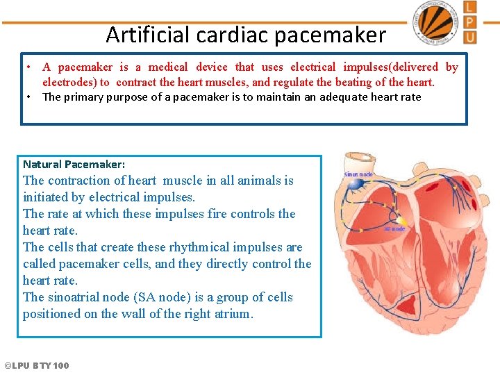 Artificial cardiac pacemaker • A pacemaker is a medical device that uses electrical impulses(delivered